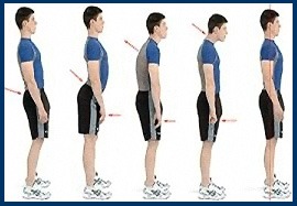 Rectitude de la Posture